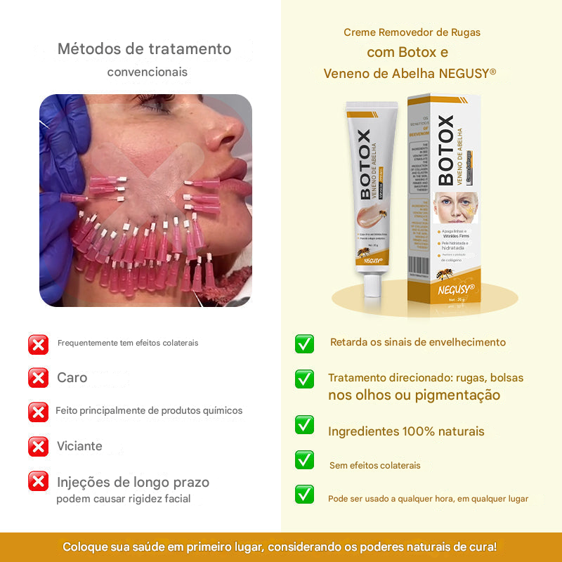 Creme removedor de rugas Botox Bee Venom - 🐝 Promoção relâmpago: só hoje! (Somente HOJE!)🔥