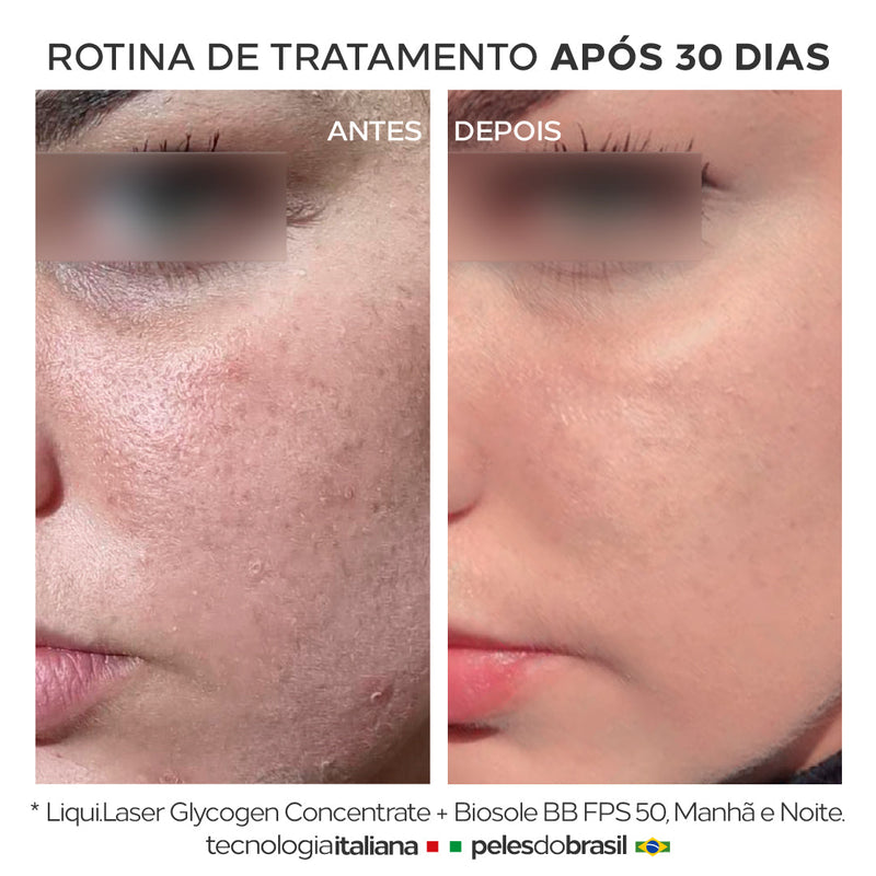 Sérum Anti-idade Clareador e Renovador de Peles 30+ - Liqui.Laser 30ml