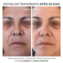 Sérum que Clareia Renova e Rejuvenesce Intensamente - BioRetinol Absolute 30ml