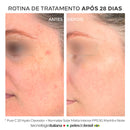 Protetor Solar 12HS Para Pele Oleosa - Normalize Matte Intense FPS 50 40ml