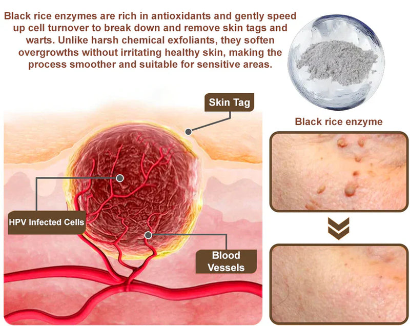 Black Rice Skin Repair Cream ⚕️ (Elimina verrugas e marcas, alivia psoríase, uniformiza a pele e reduz manchas)