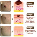 Black Rice Skin Repair Cream ⚕️ (Elimina verrugas e marcas, alivia psoríase, uniformiza a pele e reduz manchas)