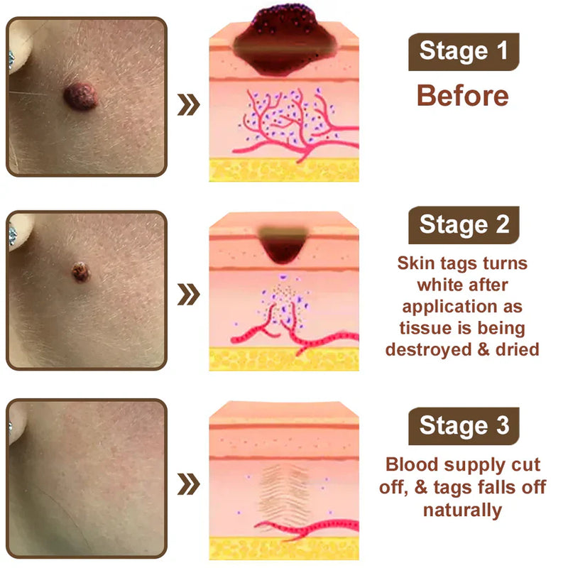 Black Rice Skin Repair Cream ⚕️ (Elimina verrugas e marcas, alivia psoríase, uniformiza a pele e reduz manchas)