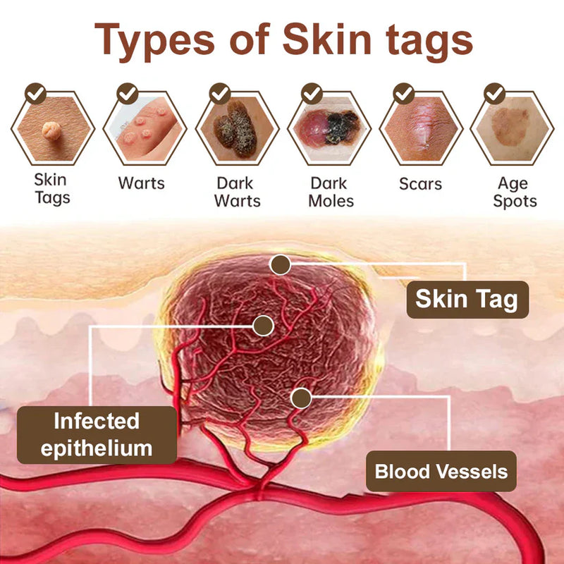 Black Rice Skin Repair Cream ⚕️ (Elimina verrugas e marcas, alivia psoríase, uniformiza a pele e reduz manchas)