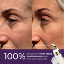 Sérum Redutor Instantâneo de Linhas