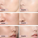 Corretivo Base Stick Coreano 2 em 1 – Cobertura Perfeita 100% Natural