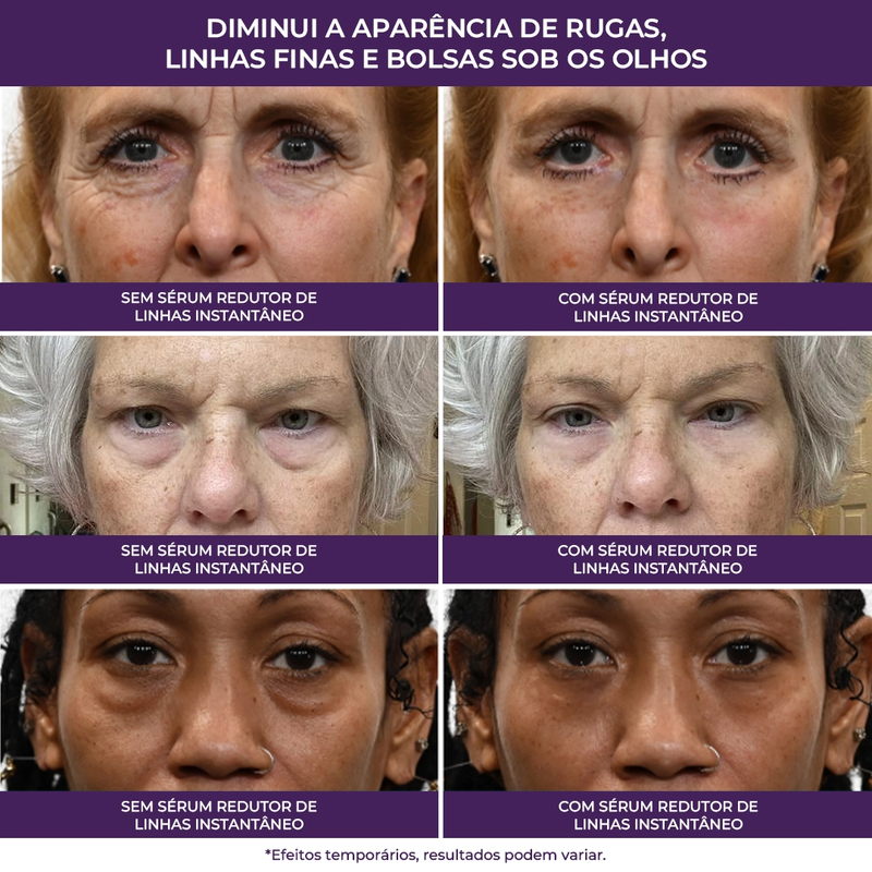 Sérum Redutor Instantâneo de Linhas