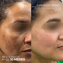 Sérum Anti-Manchas e Melasma com 3 Ácidos Clareadores – Clarivis High Potency 30ml