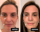 LuteinaRoll 5 em 1 ORIGINAL- Remove Olheiras, Reduz Bolsas e Revitaliza a Pele ao Redor dos Olhos