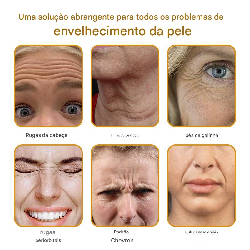 Creme removedor de rugas Botox Bee Venom - 🐝 Promoção relâmpago: só hoje! (Somente HOJE!)🔥