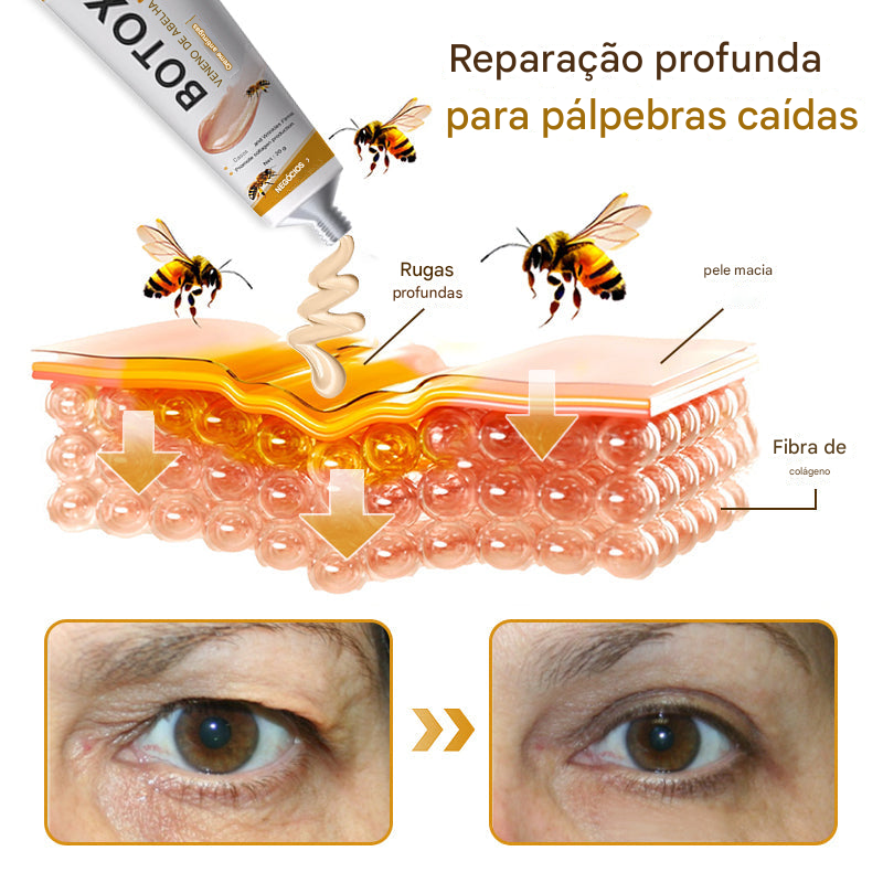 Creme removedor de rugas Botox Bee Venom - 🐝 Promoção relâmpago: só hoje! (Somente HOJE!)🔥