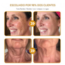 Creme removedor de rugas Botox Bee Venom - 🐝 Promoção relâmpago: só hoje! (Somente HOJE!)🔥