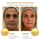 Creme removedor de rugas Botox Bee Venom - 🐝 Promoção relâmpago: só hoje! (Somente HOJE!)🔥
