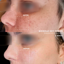 Protetor Solar Facial Clareador para Pele com Melasma - Biosole Oxy FPS 85 - 40ml