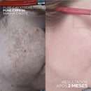 Protetor Solar 12HS Profissional Clareador Anti-Idade com Vitamina C – Pure C FPS 50 50ml