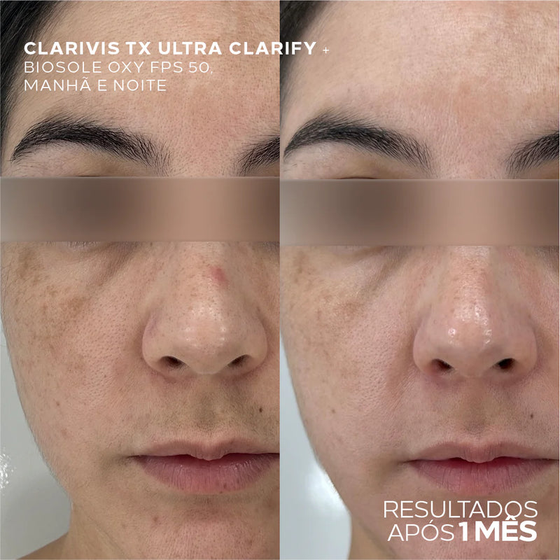 Sérum Clareador Facial Potente para Manchas Escuras e Melasma – Clarivis TX Ultra Clarify 30ml