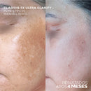 Sérum Clareador Facial Potente para Manchas Escuras e Melasma – Clarivis TX Ultra Clarify 30ml